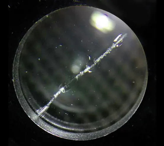 Loupe